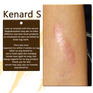 BEST SELLER DR. KELOID scar and keloid remover , keloid scar remover original , keloids removal orig #6