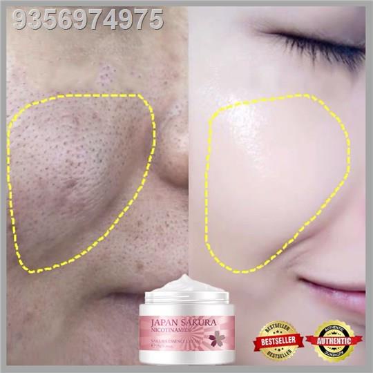 Japan Sakura Face Cream Melasma and freckles remover Acne and Pimple