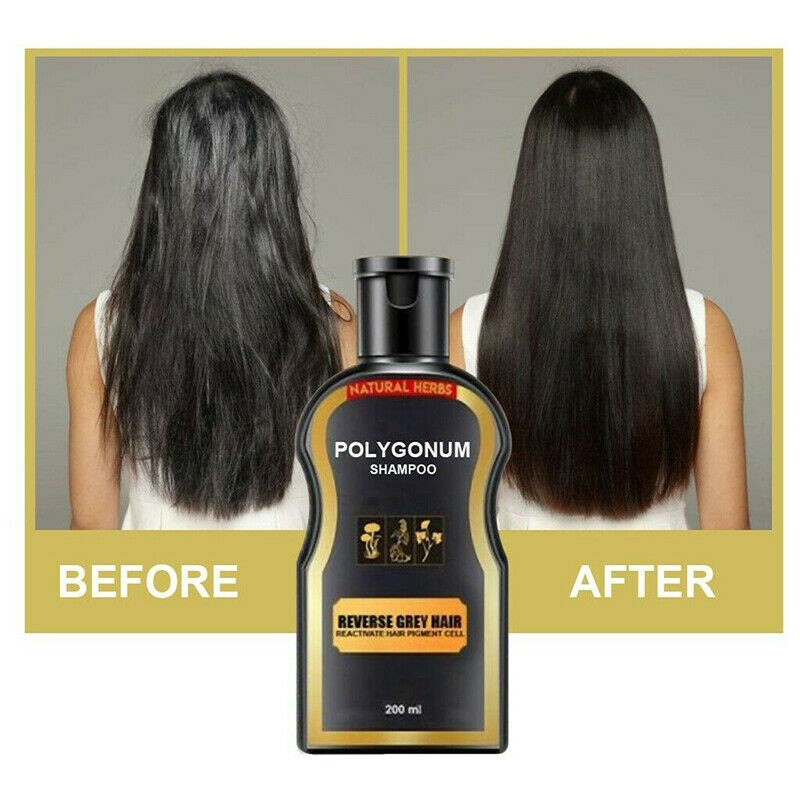 30 200ml Reverse Grey Hair Darkening Natural Polygonum He Shouwu Shampoo Men Women Hot Shopee Philippines