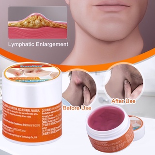 【Ship from Manila】Lymphatic Health Cream Detox Cream for Lymph Nodes Lymph Care Ointment