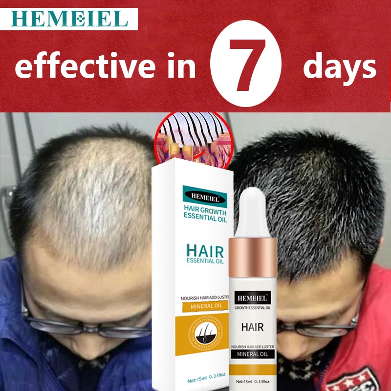 HEMEIEL Novu Hair Grower Pomade For Men Original/Hair Growth Serum Oil
