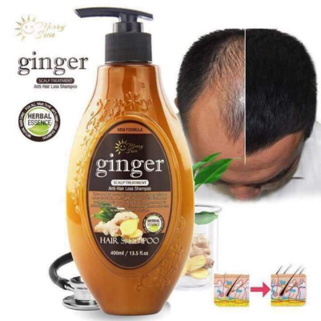 Merry sun ginger AntiHair Loss Shampoo Shopee Philippines
