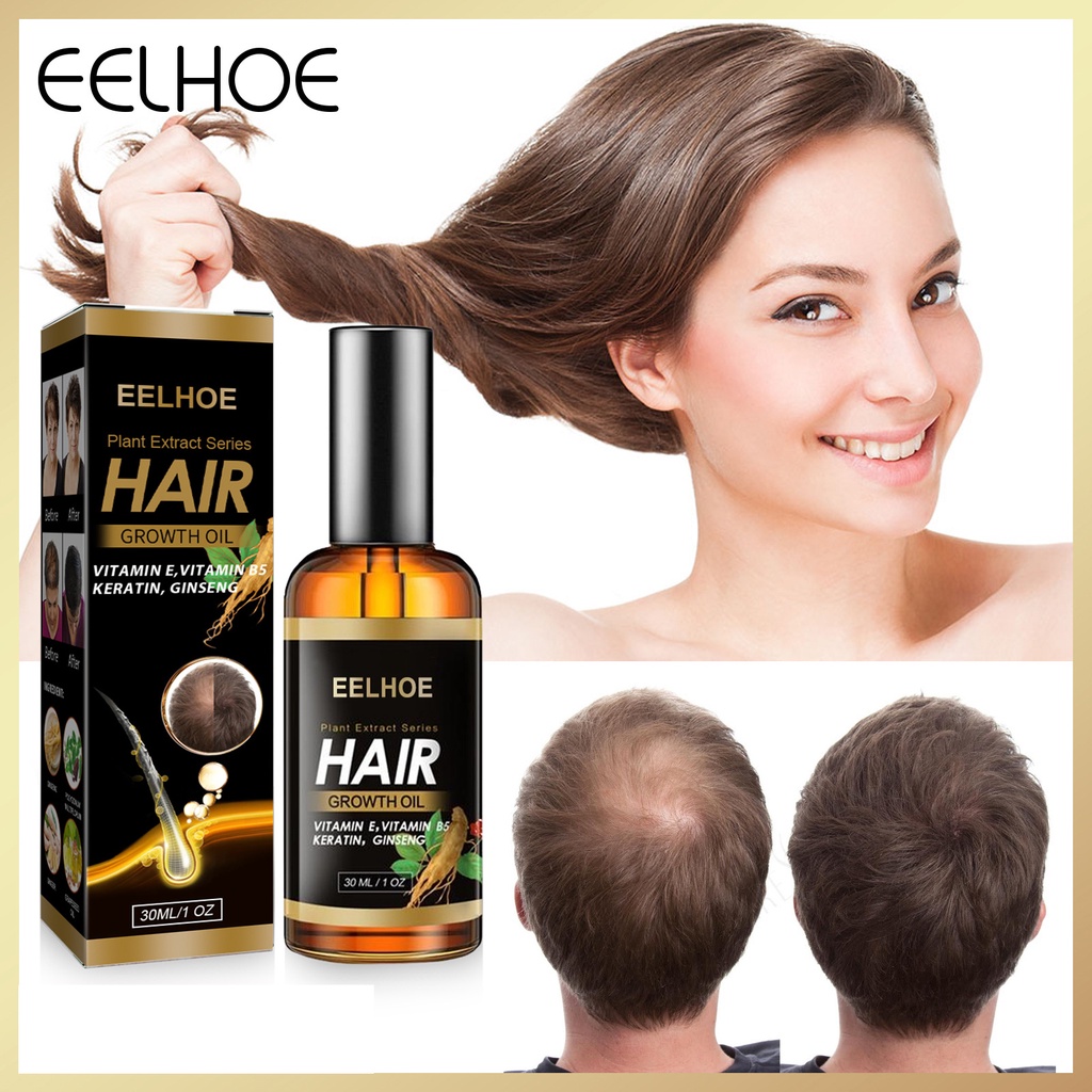 EELHOE 30ml Hair Growth Ginger Essential Treatment Scalp Dry Frizz ...