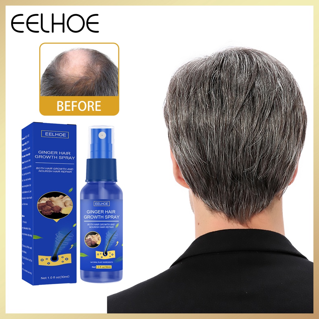 Eelhoe 30ml Ginger Hair Growth Spray Hair Growth Nutrient Solution ...