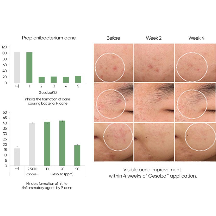 vitamin e microneedle spot cream