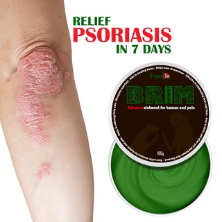 ﹍○♨100% LEGIT AND EFFECTIVE BRIM OINTMENT FOR PSORIASIS /Made for all types of skin /Scabies , Mange