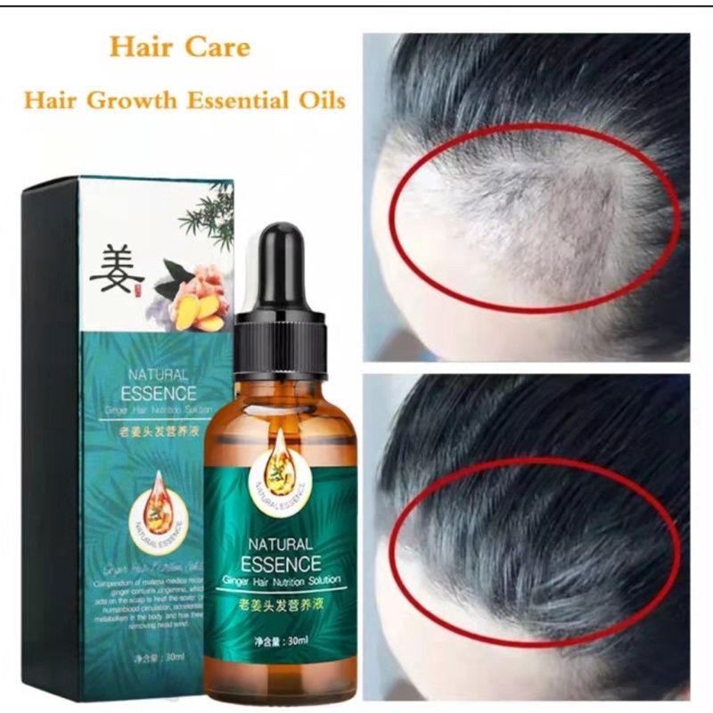 Best seller first] Hair Serum Hair Grower Fast Long Hair Treatment  Minoxidil Hair Grower Castor Oil | Shopee Philippines
