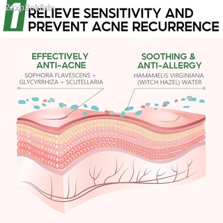 【Factory price】▧∏℡◆VIBRANT GLAMOUR Herbal Acne Treatment Toner Deep Repair Soothing Skin Reduce Pim #8