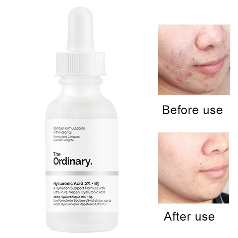 ordinary hydraulic acid serum
