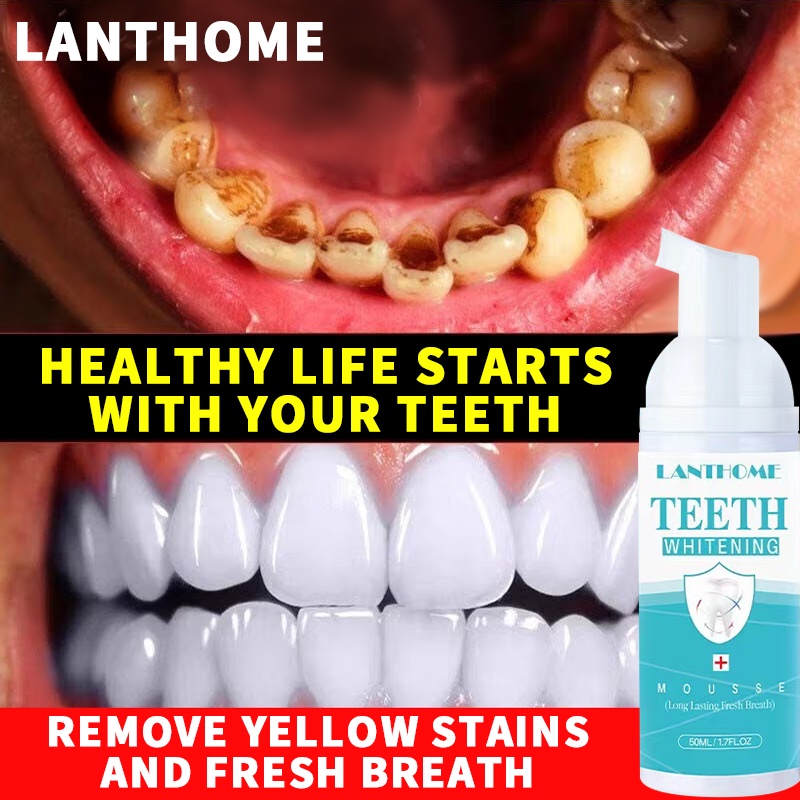 Teeth Cleaner Mousse Remove Yellow Stains Plaque Teeth Bright Whitening Fresh Breath Tooth Oral Care