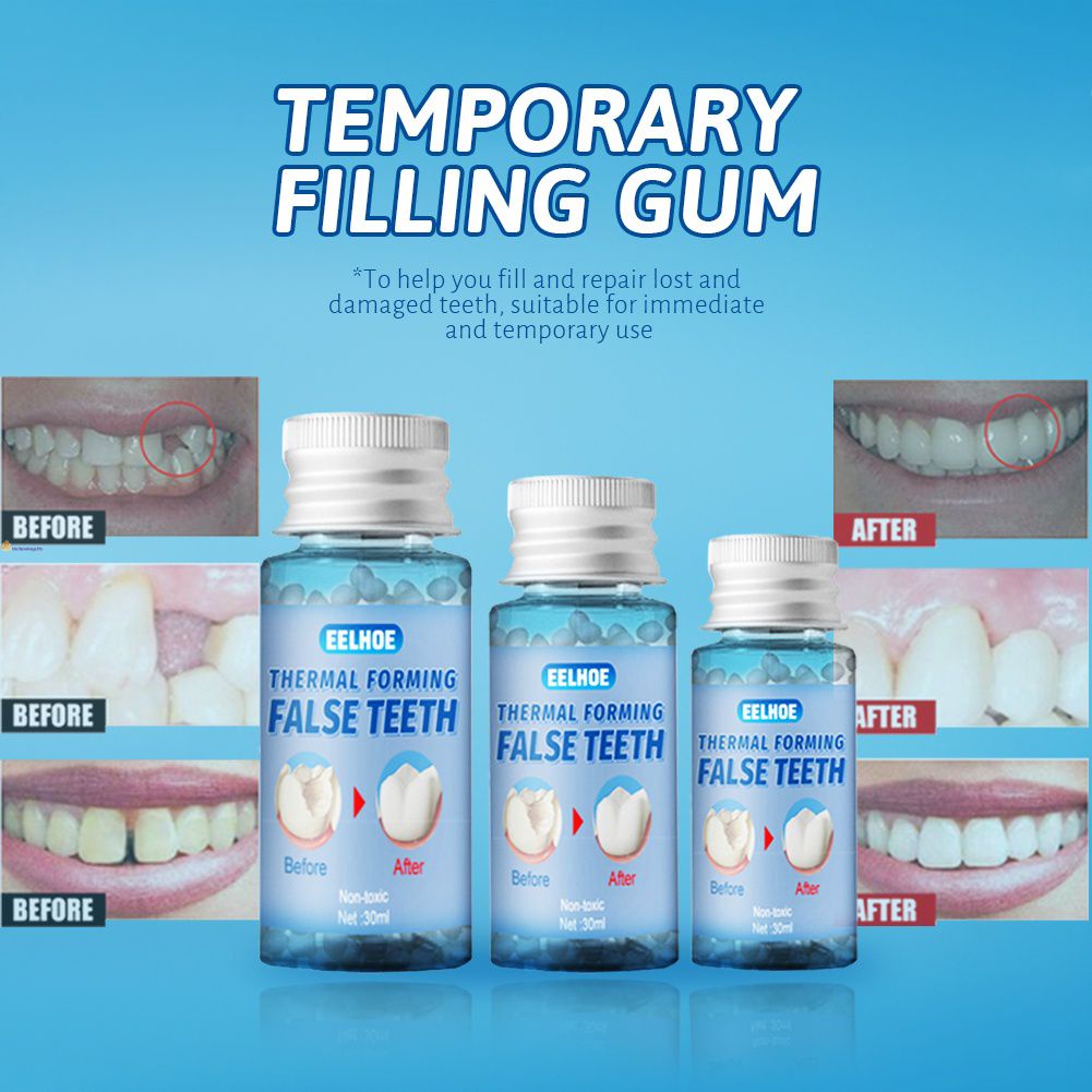 10g/20g/30g Temporary Tooth Restoration Kit Glue Denture Teeth And Gaps