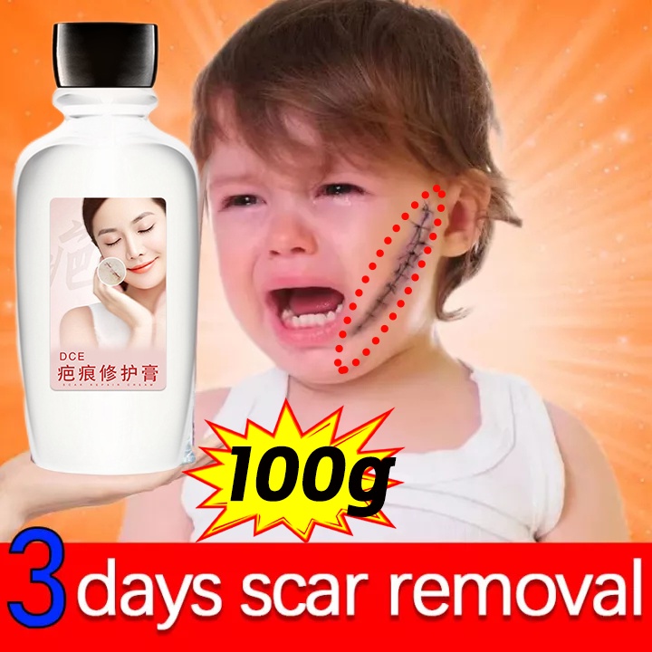 Scar Removal Cream Peklat Remover Acne Treatment Scar remover cream
