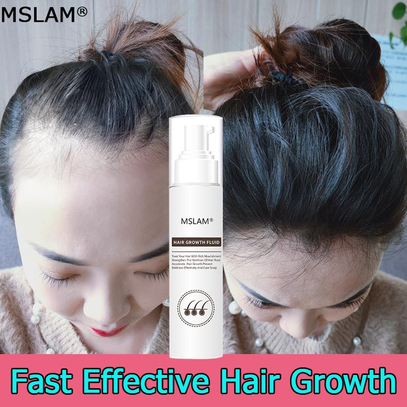 MSMAL Hair Growth Essence Hair Grower Hair Conditioner Essence Prevents Hair  Loss Hair care Essence | Shopee Philippines