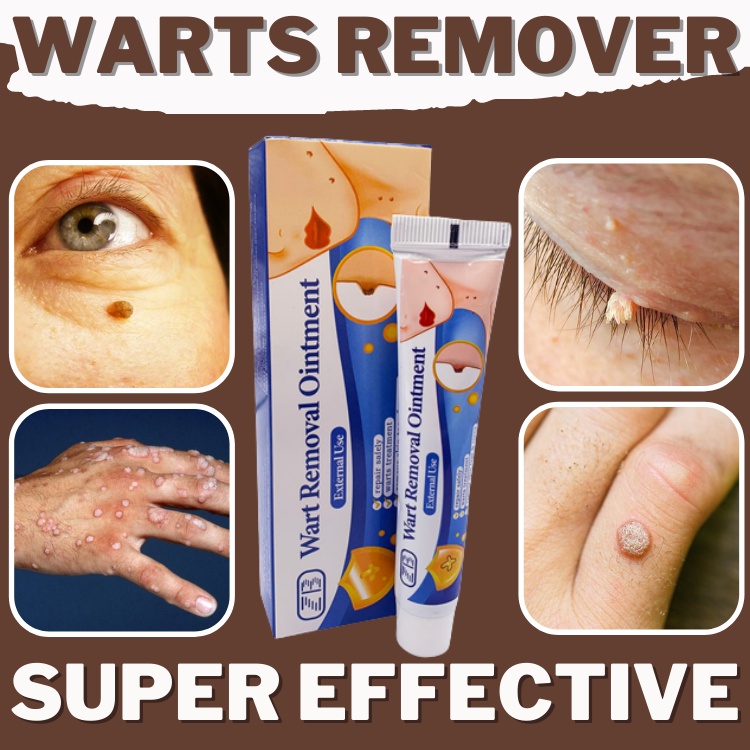 Warts Remover Original Cream Kasoy Cream Mole, Warts & Skin Tag Removal