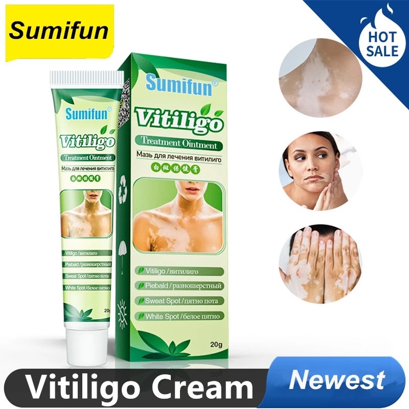 Sumifun 20g Chinese Herbal Vitiligo Leukoplakia Disease Treatment