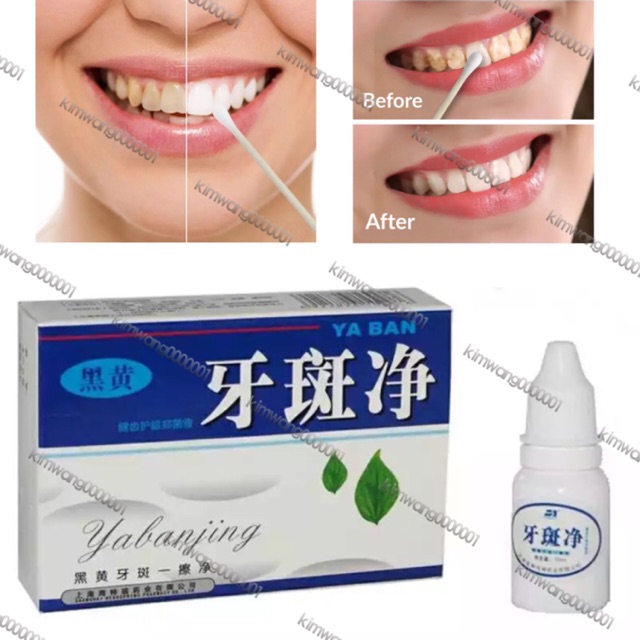 Chinese Medicine White Tcm Teeth Whitening Shopee Philippines