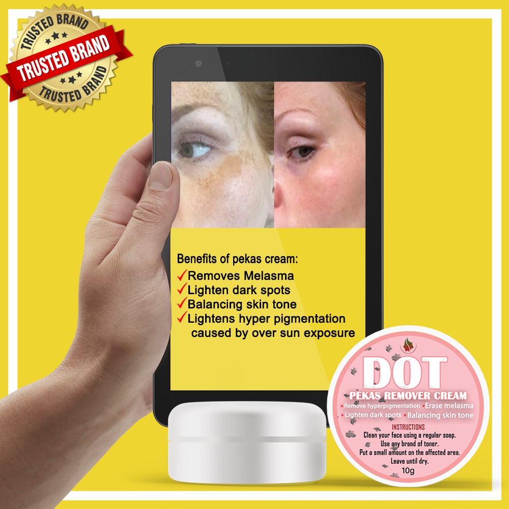 dot pekas remover cream