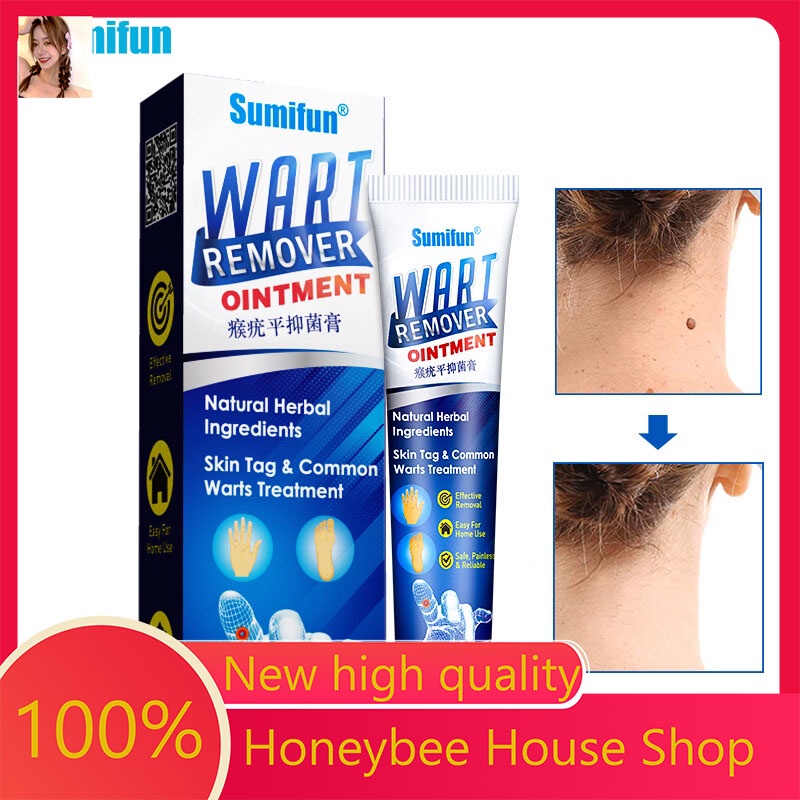 COD Painless warts removal genital warts & wart remover original mole