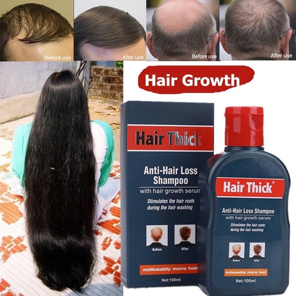 Hair Thick Hair Growth Shampoo Hair Grower Shampoo not Spray Anti Hair ...