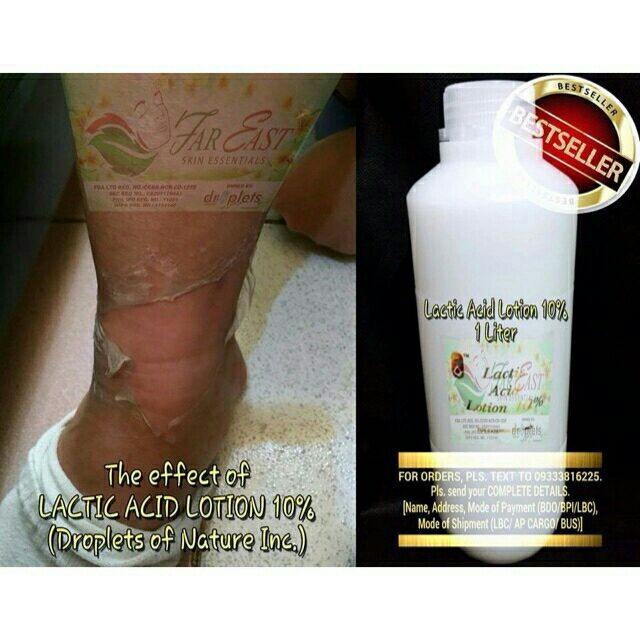 Lactic Acid Peeling Lotion 280ml Shopee Philippines