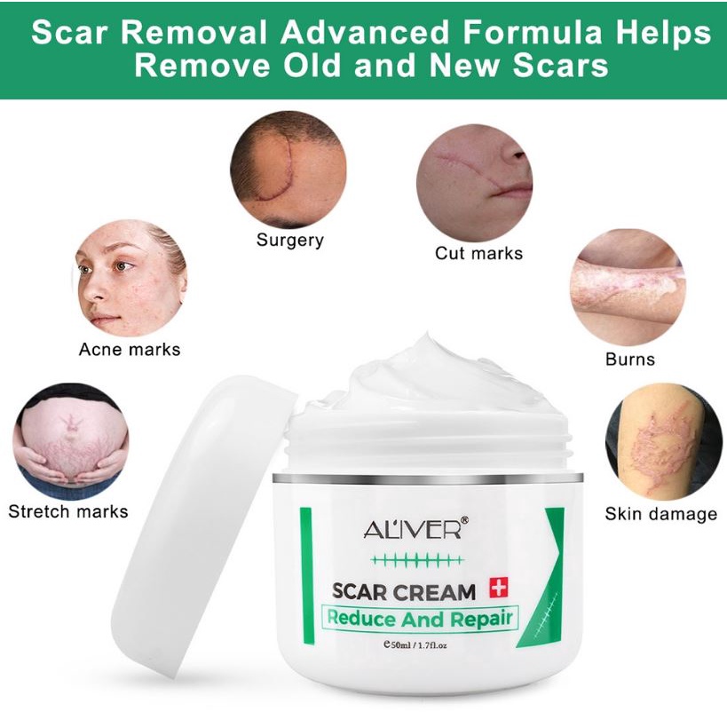 ALIVER Effective Old Scars Removal Cream Stretch Mark Treatment 50ml