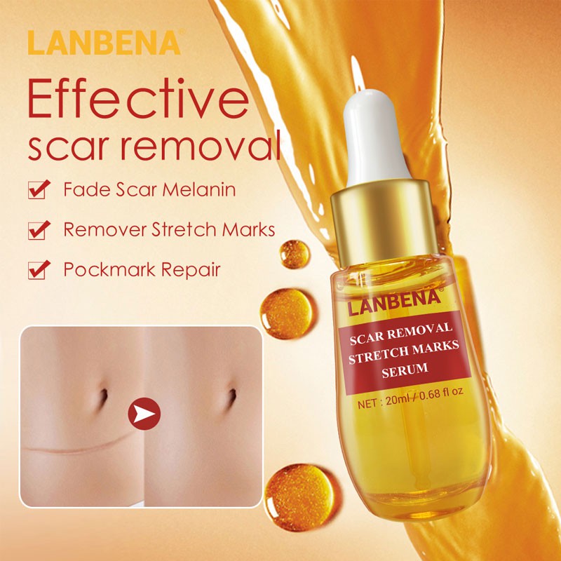 lanbena scar removal stretch marks serum watson