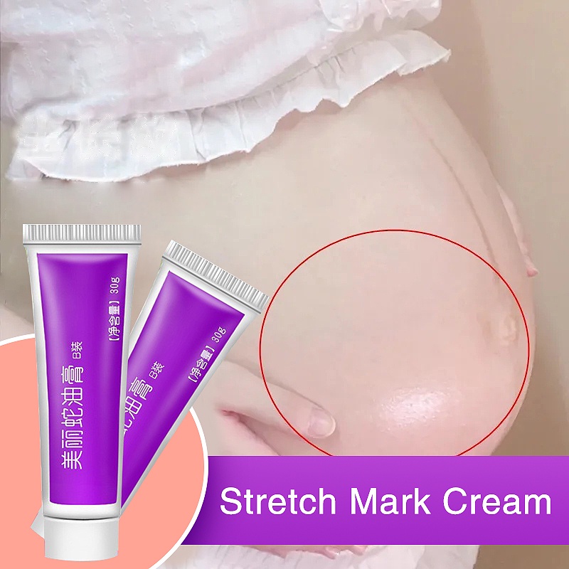 Stretch Mark Cream Scar Remover Keloid Scar Remover Anti Wrinkle Anti