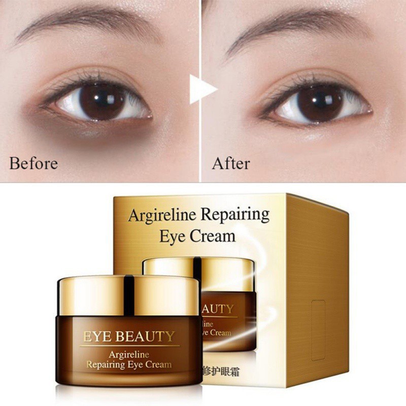 eye cream menghilangkan dark circle