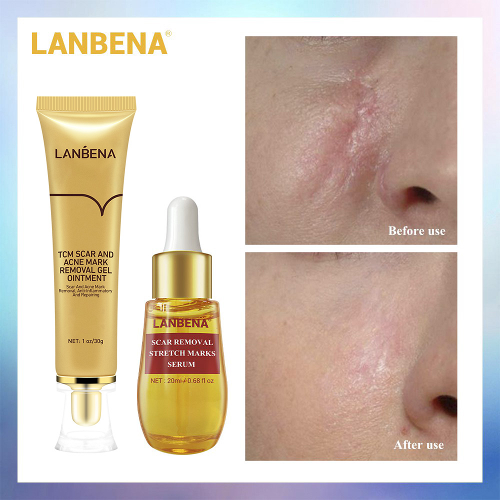 2Pcs For LANBENA Acne Scar Remove Serum+Acne Treatment Cream SetSkin ...