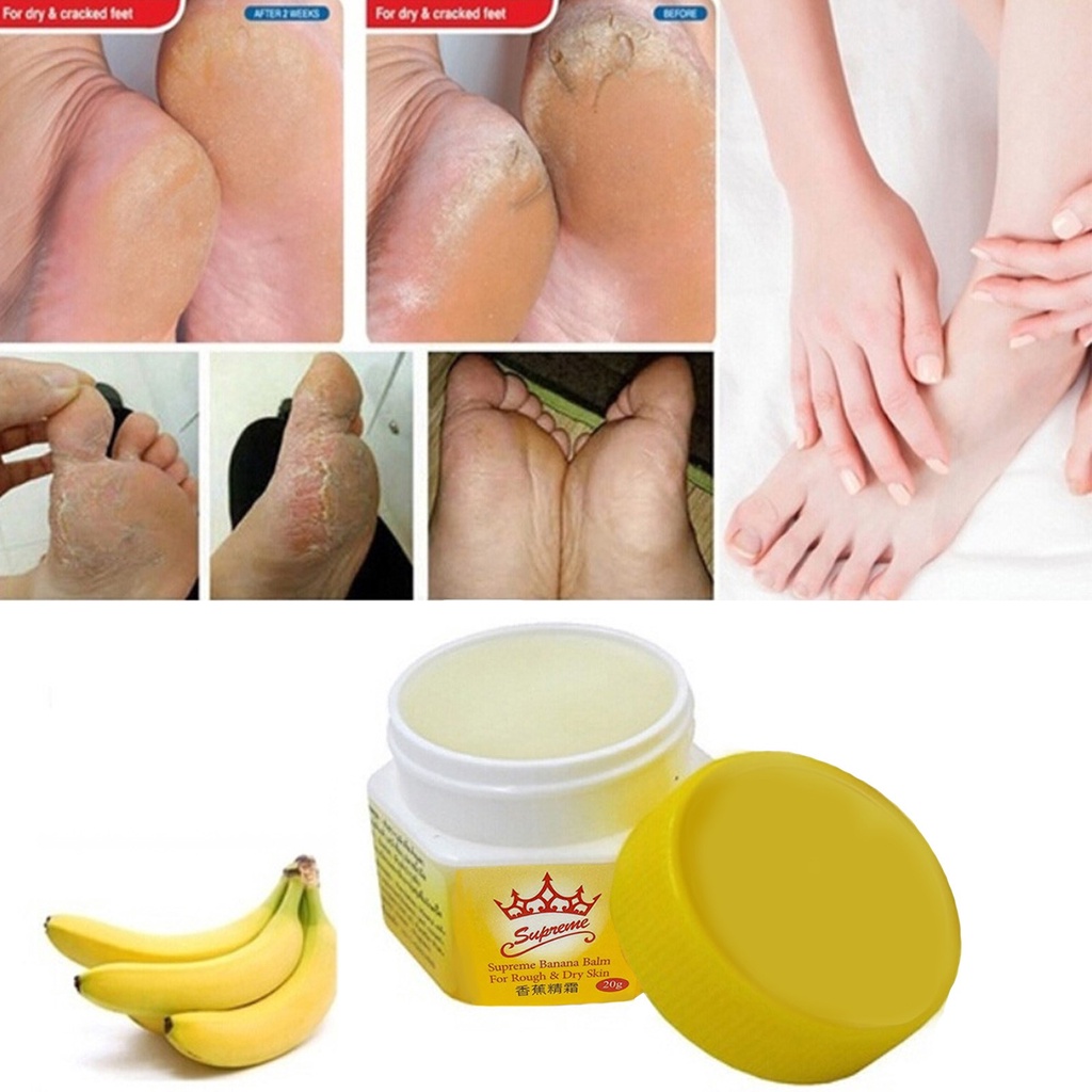 Hand, Foot, Banana, Heel, Dry Crack Prevention Cream, Foot Care Cream