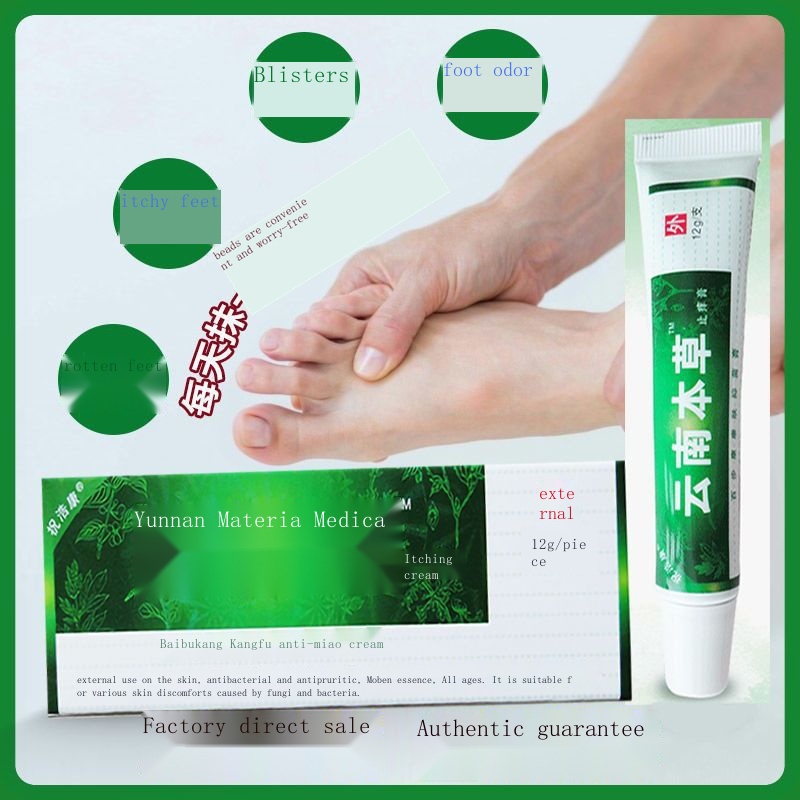 Athlete s foot cream, itchy feet, small blisters, rotten feet, smelly