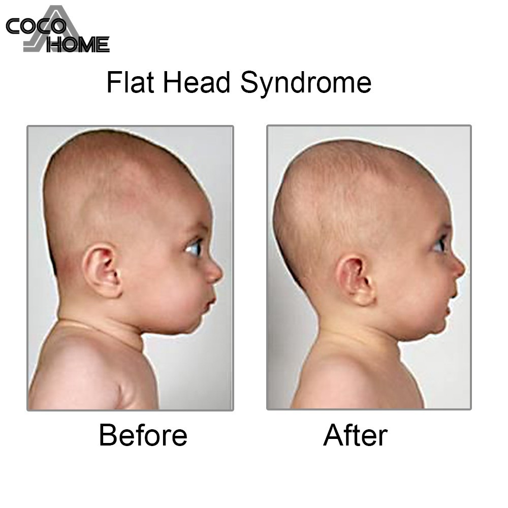 Cohom Baby Cot Pillow Preventing Flat Head Neck Syndrome For Newborn Girl Boy Shopee Philippines