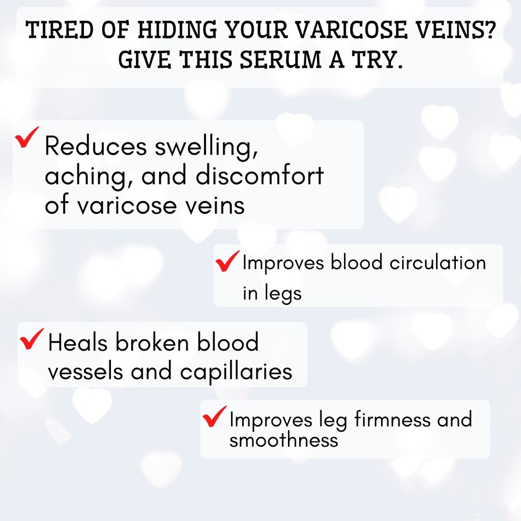 Mainit na benta 24k Varicare AntiVaricose Veins Serum 30 mL Treatment for Varicose Veins and