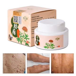 25g Herbal Lipoma Removal Cream Lipoma Medicine Treat Tumor Skin ...