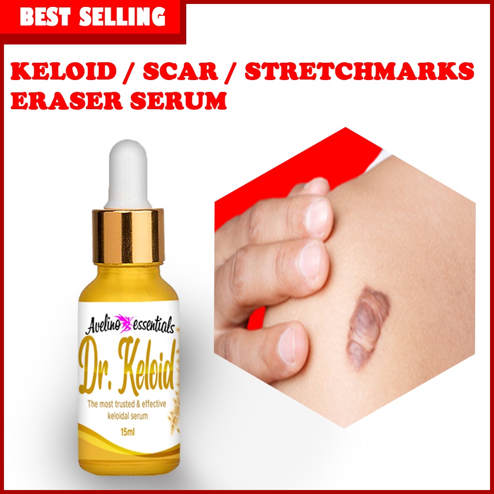 BEST SELLER DR. KELOID scar and keloid remover , keloid scar remover original , keloids removal orig #1