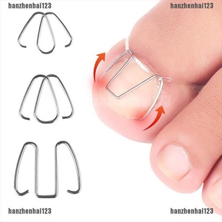 hanzhenhai123Nail Art Ingrown Toe Nail Correction Tool Toenail Nail