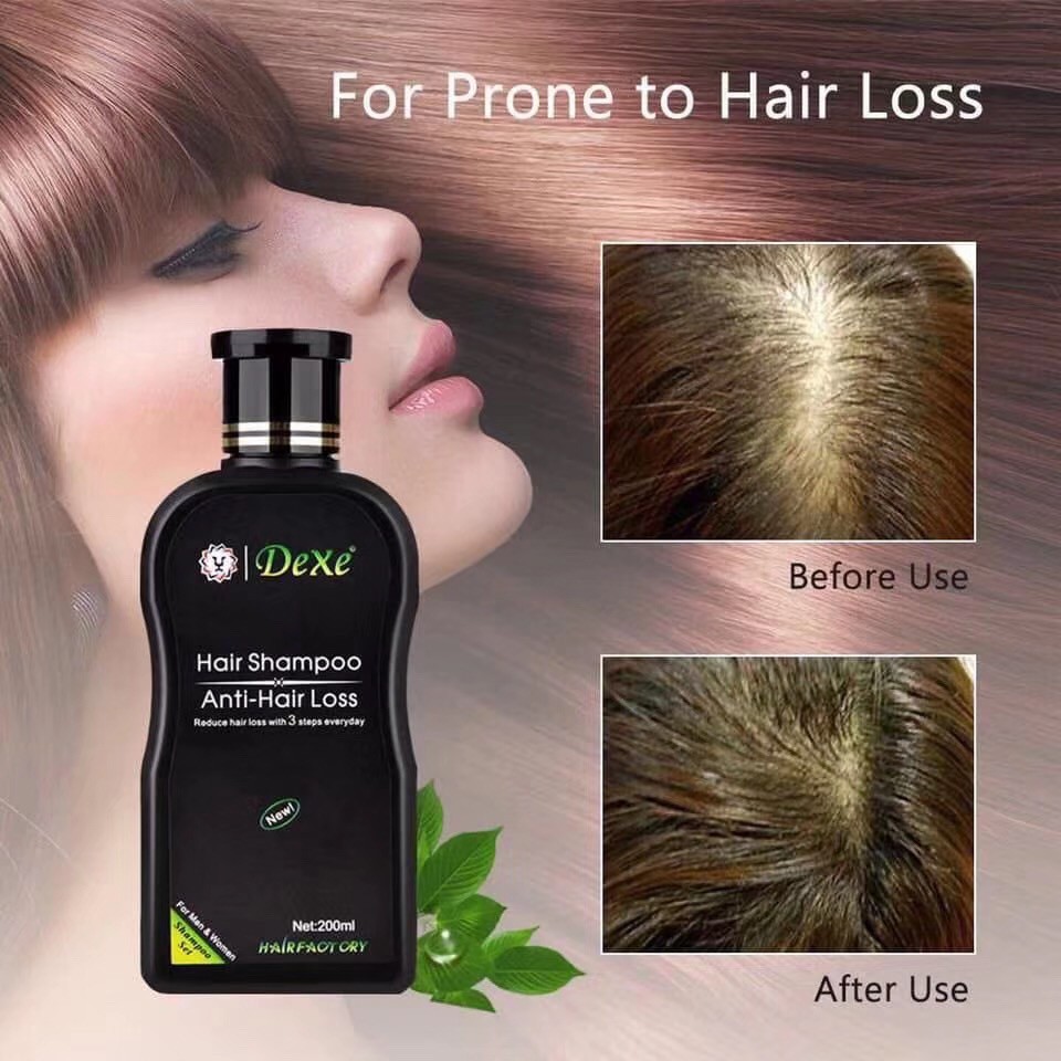 Dexe Anti-hair Loss Growth Treatment Shampoo 200ml 