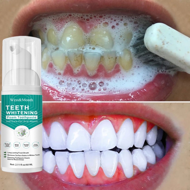 Teeth Whitening Toothpaste Mousse Mouthwash Remove Tartar Oral Care