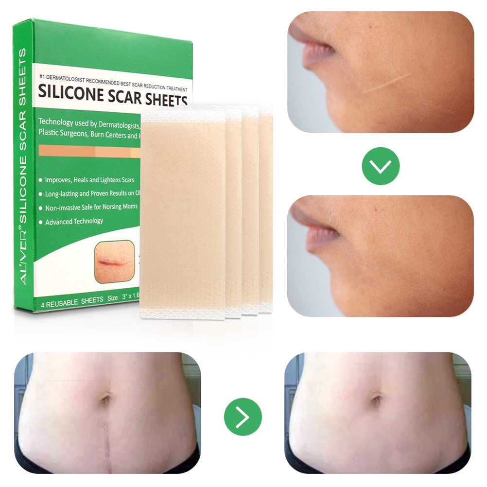 scar reduction patches