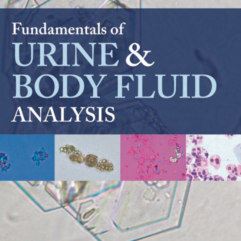 fundamentals of urine and body fluid analysis 4ed