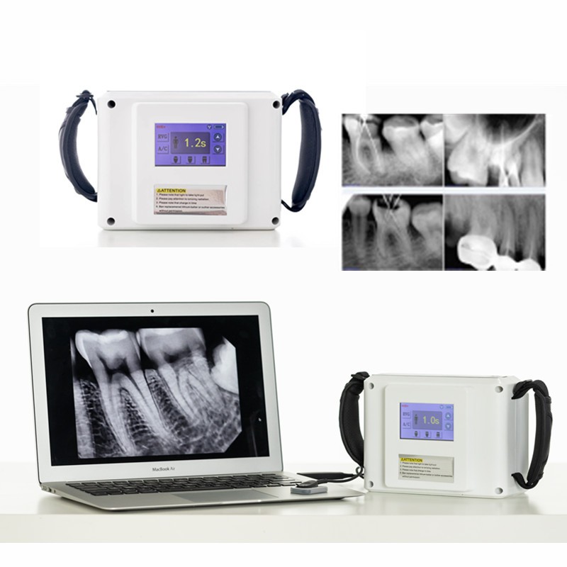 dental-x-ray-unit-xray-portable-machine-dental-x-ray-equipment-opg