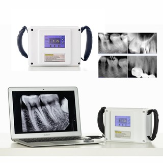 Dental x ray Unit xray Portable Machine Dental x-ray Equipment Opg Dental for Dental Clinic