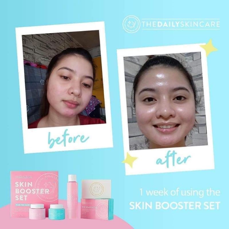 skin booster set
