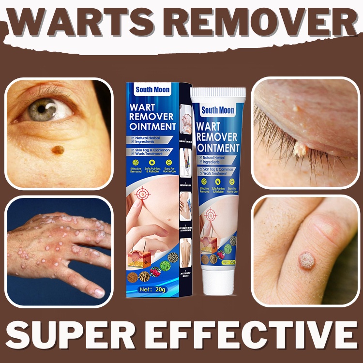 Warts Remover Original Kulugo Remover Cream Skin Tag Remover Natural Herbal Wart Treatment 20g