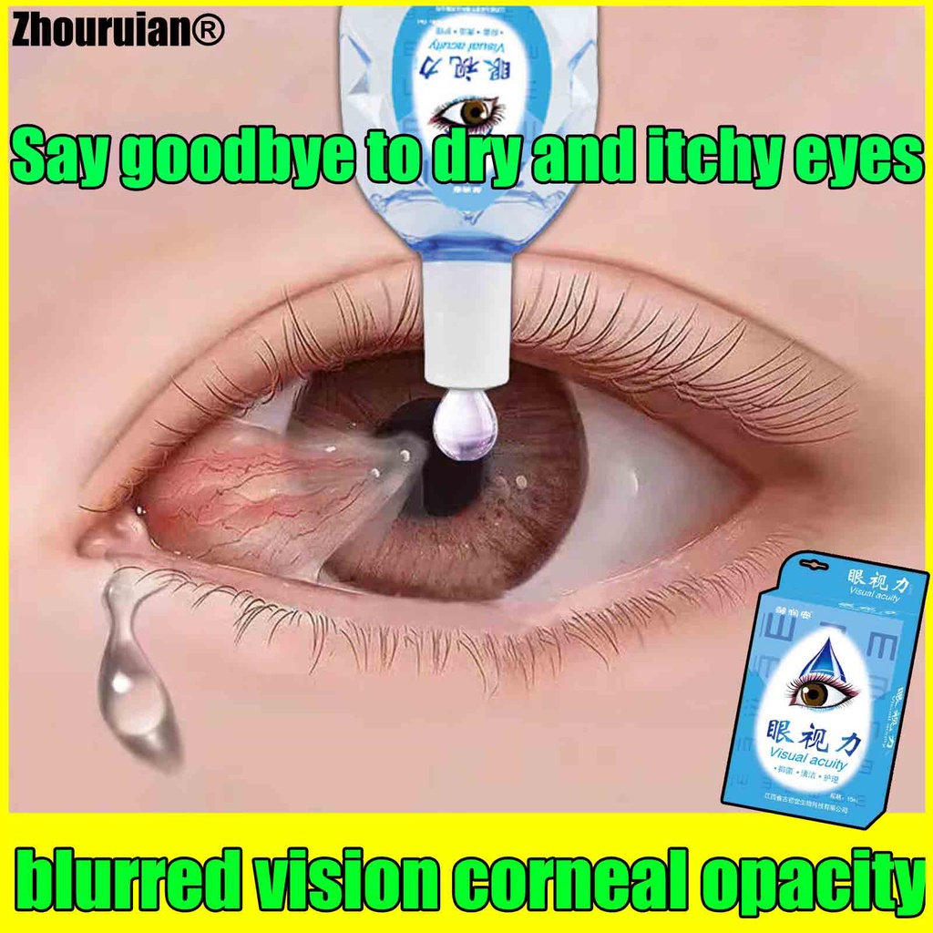 eye drops！Antifatigue 15ml, clearing heat and antispasmodic