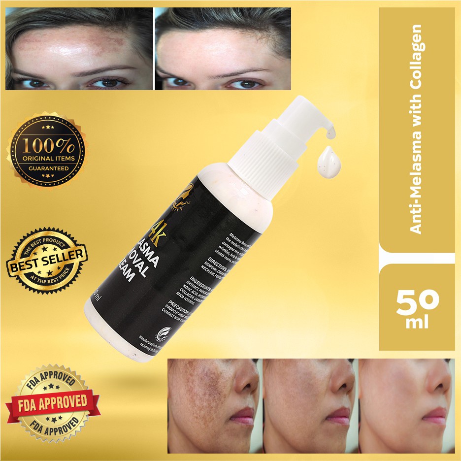 acne pigmentation removal cream