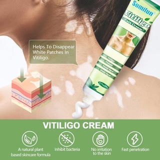 Vitiligo Treatment Cream Vitiligo Cream White Spots Tag Remover Ointment Care Medical Supplies
