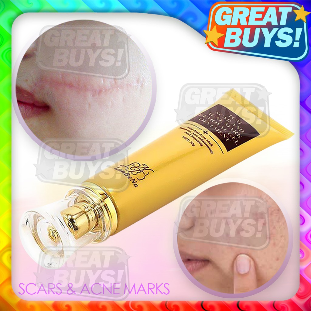 Pimple Marks Treatment Best Pimple Mark Remover Home Remedies To Remove