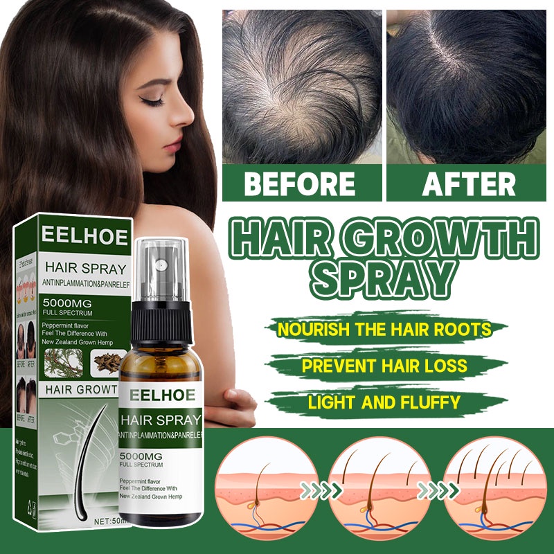 Eelhoe Hair Growth Serum Fast Hair Growth Spray Hair Essence And Scalp Treatments Anti Hair Loss 8366