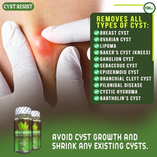 Cyst Resist - Anti-Cyst, Cyst Prevention, Cyst Remover, Vitamins for Cysts, Anti-Bukol, Bukol Remove